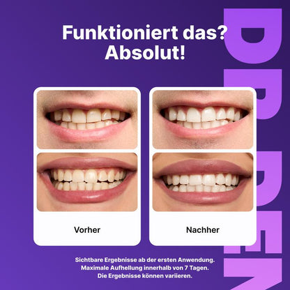 Balnora™ Whitening Zahnstreifen