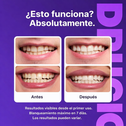 Balnora™ Tiras Blanqueadoras Dentales